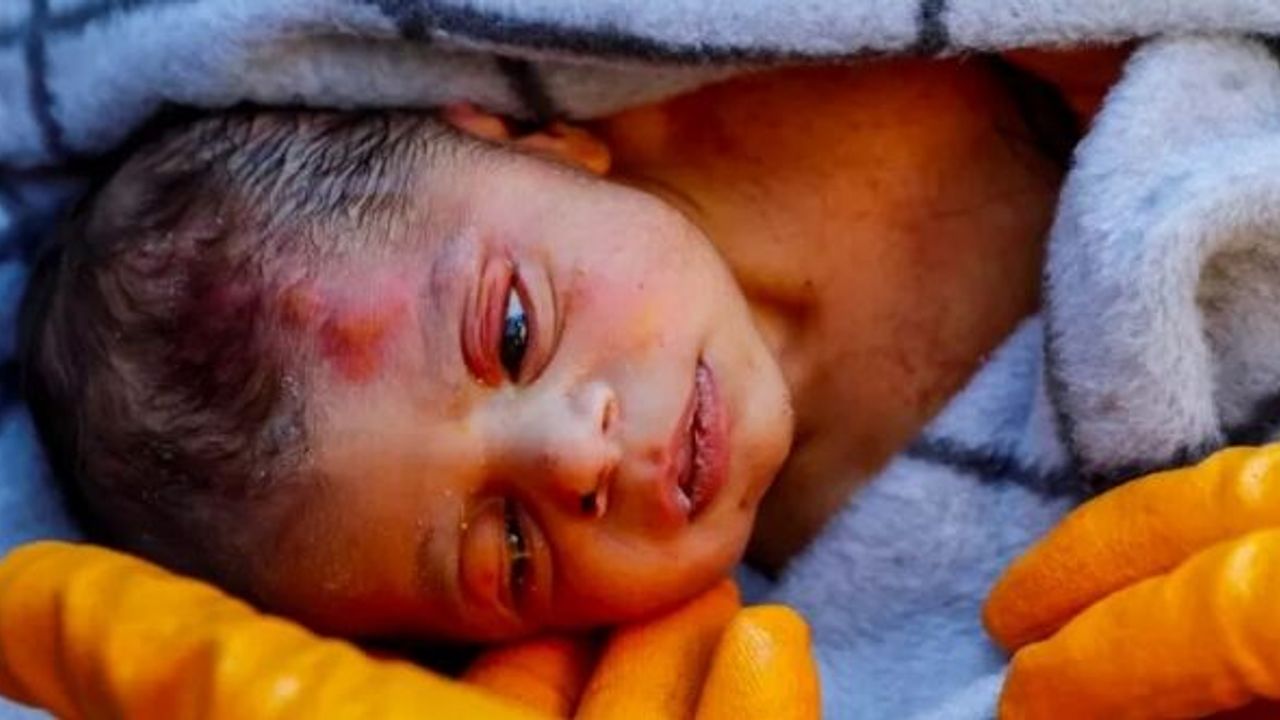 DAHA 20 GÜNLÜK, ELİNDE ANNESİNİN SAÇIYLA KURTARILDI