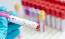 KIZILAY'DAN HIV İDDİALARINA AÇIKLAMA