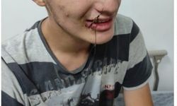 Bu kez oltaya çocuk takıldı