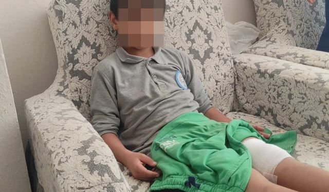 Bursa'da okula giden çocuğa köpek saldırdı