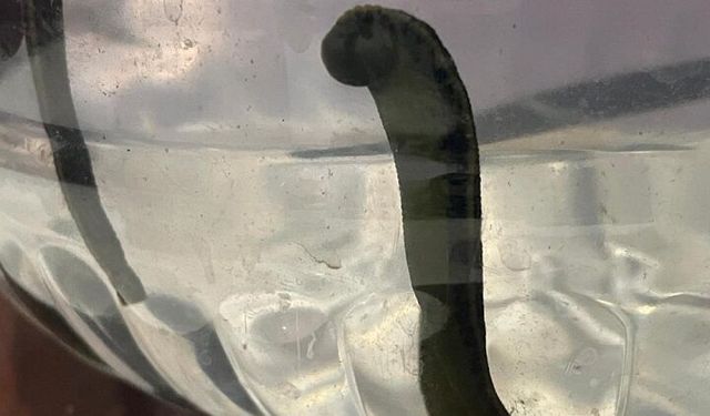 Bursa’da sülükle cilt bakımı trend oldu