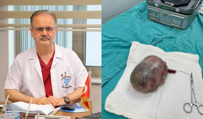 Testisinden 20 santimlik tümör çıktı