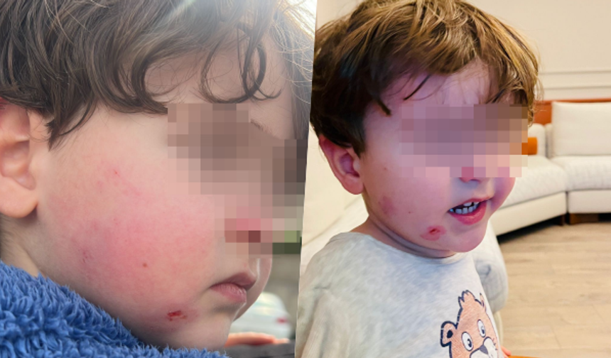 Bursa'da kreşe bıraktığı çocuğunu darp edilmiş şekilde aldı